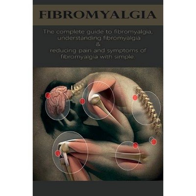 Fibromyalgia - by  David Anthony (Paperback)