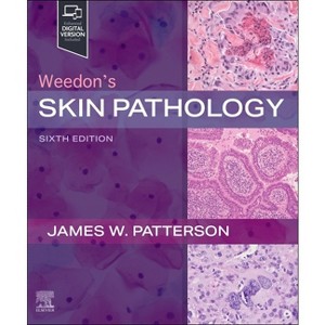 Weedon's Skin Pathology - 6th Edition by  James W Patterson (Hardcover) - 1 of 1