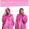 Tirrinia Wearable Blanket Oversized Hoodie for Adults, Patterns Sweatshirt Blanket, as Warm & Funny Gifts for Men Women Girlfriend - 2 of 4