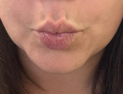 Guest review image 1 of 2, zoom in