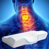 Dr pillow Carbon Pedic Pillow Cases set of 2 - 4 of 4