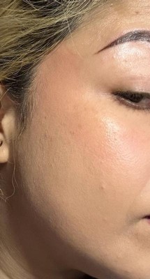 Guest review image 1 of 2, zoom in