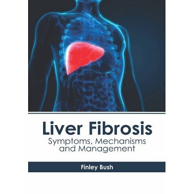 Liver Fibrosis: Symptoms, Mechanisms and Management - by  Finley Bush (Hardcover)