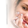 Unique Bargains Facial Fine Pimple Extractor 1 Pc - 4 of 4