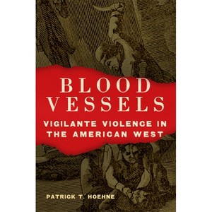 Blood Vessels - by  Patrick T Hoehne (Hardcover) - 1 of 1