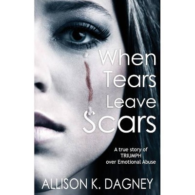 When Tears Leave Scars - by  Allison K Dagney (Paperback)