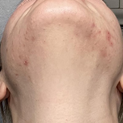 Guest review image 2 of 2, zoom in