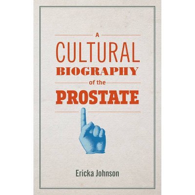 A Cultural Biography of the Prostate - by  Ericka Johnson (Paperback)