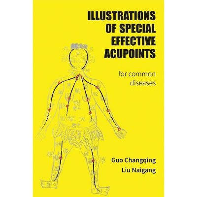 Illustrations Of Special Effective Acupoints for common Diseases - by  Changqing Guo (Paperback)