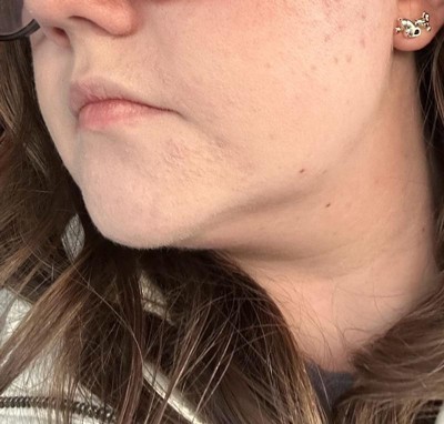 Guest review image 1 of 1, zoom in