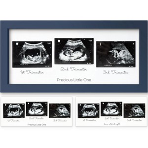 KeaBabies Trio Baby Sonogram Picture Frame, Baby Ultrasound Picture Frames for Baby Nursery, Mom to Be Gifts - 1 of 4