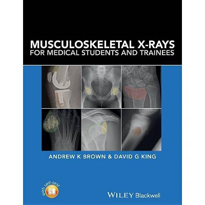 Musculoskeletal X-Rays for Medical Students and Trainees - by  Andrew K Brown & David G King (Paperback)