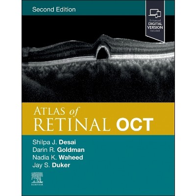 Atlas of Retinal Oct - 2nd Edition by Jay S Duker & Nadia K Waheed & Darin  Goldman & Shilpa J Desai (Hardcover)