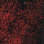 clear push pins bundle