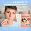 MEDca Hydrocolloid Acne Patches for Face – 108-Count Pimple Spot Bandages in 2 Sizes for Acne, Zits & Blackheads - 3 of 4