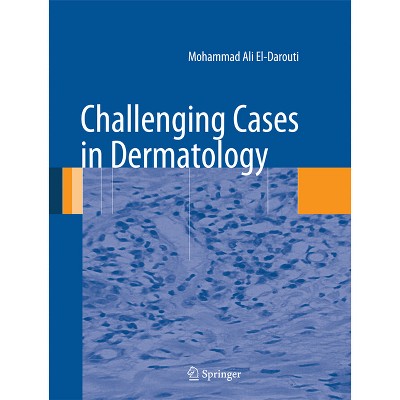 Challenging Cases in Dermatology - by  Mohammad Ali El-Darouti (Hardcover)