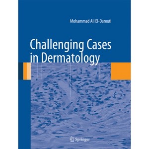 Challenging Cases in Dermatology - by  Mohammad Ali El-Darouti (Hardcover) - 1 of 1