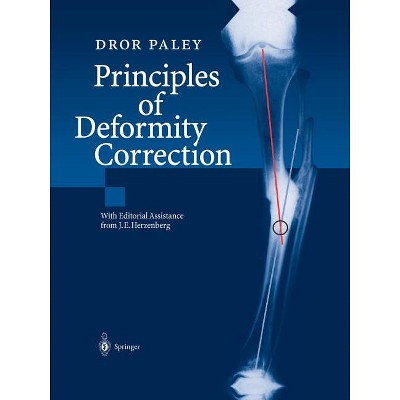 Principles of Deformity Correction - by  Dror Paley (Paperback)