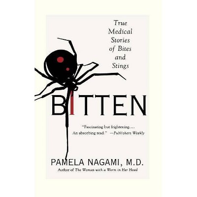 Bitten - by  Pamela Nagami (Paperback)