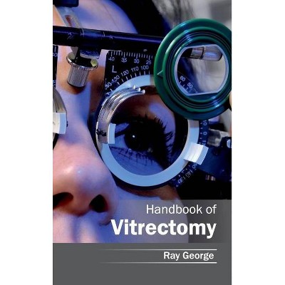 Handbook of Vitrectomy - by  Ray George (Hardcover)