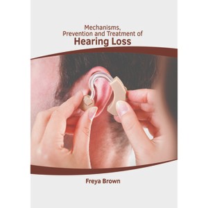 Mechanisms, Prevention and Treatment of Hearing Loss - by  Freya Brown (Hardcover) - 1 of 1