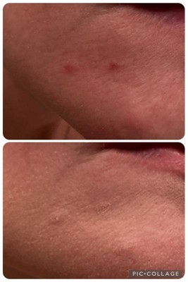 Guest review image 1 of 3, zoom in