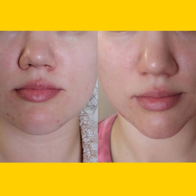 No B.S. Skincare Purifying Facial Toner - 5 fl oz, 5 of 11