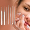 Unique Bargains Facial Pimple Extractor Tool Kit Silver Tone Set of 7 - 4 of 4