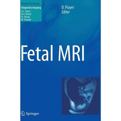 Fetal MRI - by  Daniela Prayer (Hardcover)