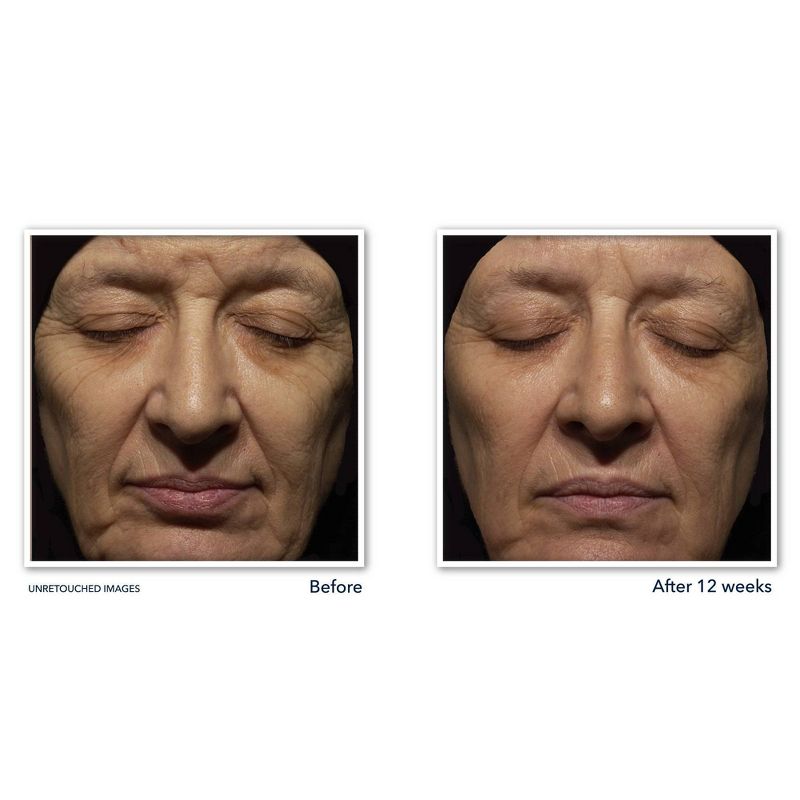 RoC Retinol Anti-Aging + Firming Night Face Moisturizer - 1 fl oz, 4 of 14