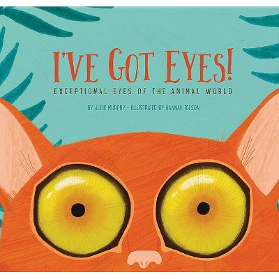 I've Got Eyes! - by  Julie Murphy (Hardcover)