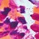 fiery tie dye