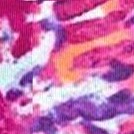 fiery tie dye