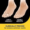 Dr. Scholls - Clear Away Wart Remover, Thin & Flexible Duragel, Cushions (9 Ct) & Medicated Discs (12 Ct) - 4 of 4