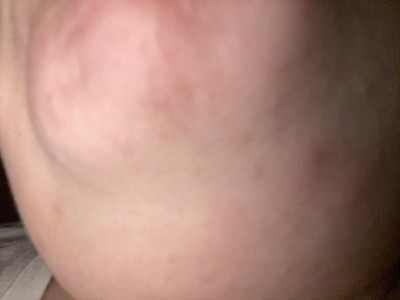 Guest review image 1 of 2, zoom in