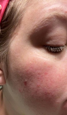 Guest review image 1 of 3, zoom in