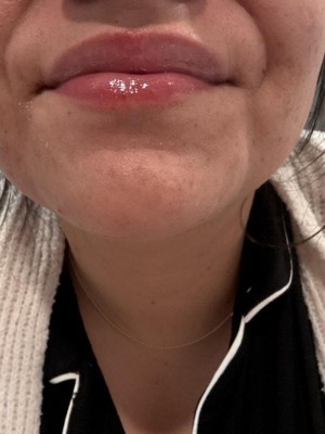 Guest review image 1 of 2, zoom in