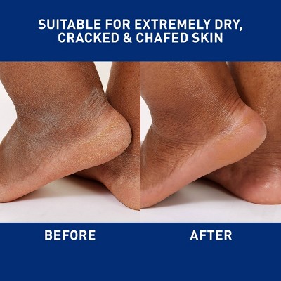 CeraVe Healing Ointment Skin Protectant, Soothes Dry, Cracked and Chafed Skin, Non-Greasy Unscented - 12oz, 6 of 18