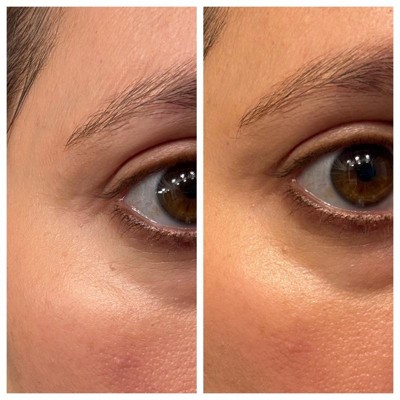 Guest review image 1 of 1, zoom in