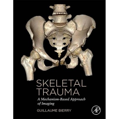 Skeletal Trauma - by  Guillaume Bierry (Hardcover)