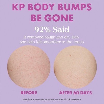 Kopari Women&#39;s KP Body Bumps Be Gone - 8.45oz - Ulta Beauty_3