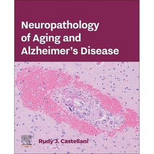 Neuropathology of Aging and Alzheimer's Disease - by  Rudy J Castellani (Paperback) - 1 of 1