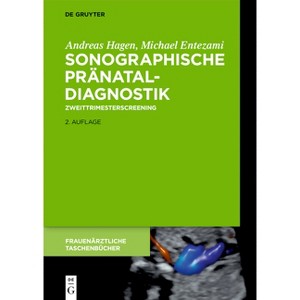 Sonographische Pränataldiagnostik - (Frauenärztliche Taschenbücher) by  Michael Entezami & Andreas Hagen (Hardcover) - 1 of 1