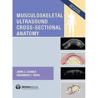 Musculoskeletal Ultrasound Cross-Sectional Anatomy - by  John C Cianca & Shounuck I Patel (Hardcover)