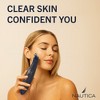 Nautica PC250 Blackhead Remover Vacuum Pore Extractor Black Head Remover for Face&Nose with 3 Adjustable Suction Levels - 2 of 4