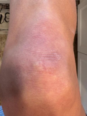 Guest review image 2 of 2, zoom in