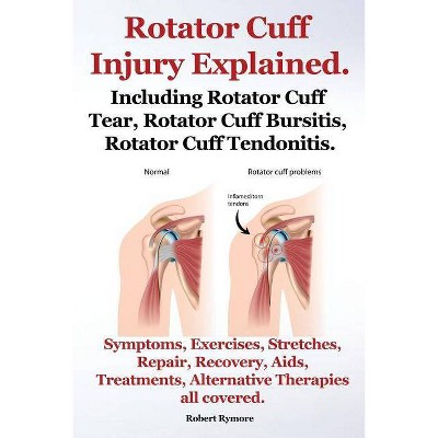 Rotator Cuff Injury Explained. Including Rotator Cuff Tear, Rotator Cuff Bursitis, Rotator Cuff Tendonitis. Symptoms, Exercises, Stretches, Repair,