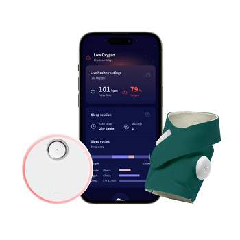 Owlet Dream Sock - FDA-Cleared Smart Baby Monitor with Live Health Readings and Notifications