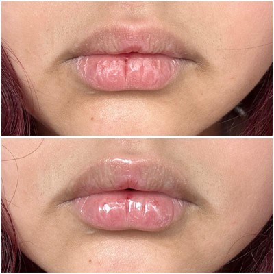 Guest review image 1 of 1, zoom in