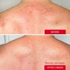 FIRST AID BEAUTY Body Acne Clearing Mist with 2% Salicylic Acid  - 3oz - Ulta Beauty - 4 of 4
